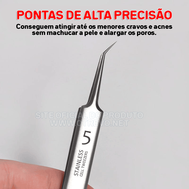 Pinças Super Skin - Kit Removedor de Cravos e Espinhas (3 Peças)