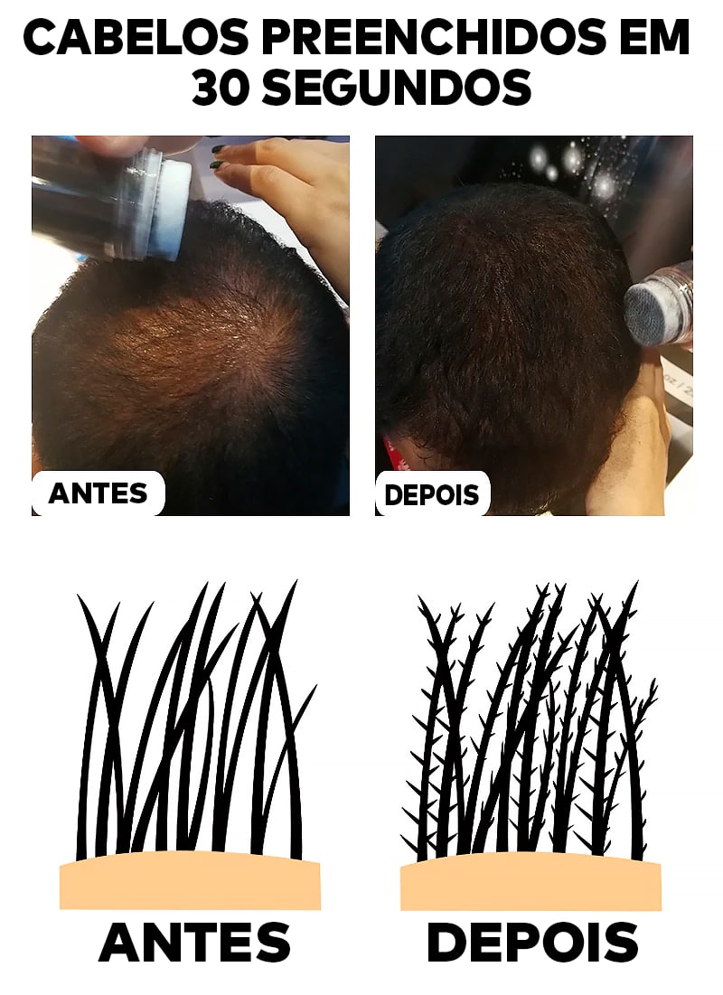 Queratina em Pó para Cobertura de falhas no Cabelo ®TOPHAIR 3 EM 1 (100% NATURAL)