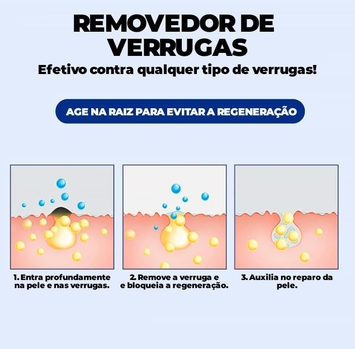 Removedor de Verrugas Olho de Peixe ®ClearCream